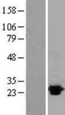 Western Blot: Sigma-1 R/OPRS1 Overexpression Lysate [NBL1-13947]