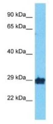 Western Blot: OR10A2 Antibody [NBP3-09848]