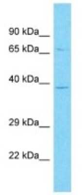 Western Blot: OR10A3 Antibody [NBP3-09844]
