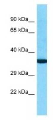 Western Blot: OR10K2 Antibody [NBP3-09855]
