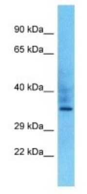Western Blot: OR10P1 Antibody [NBP3-09856]