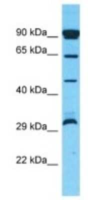 Western Blot: OR10P1 Antibody [NBP3-09857]