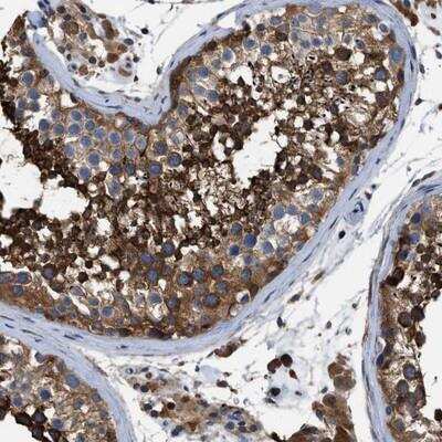 Immunohistochemistry: OR10S1 Antibody [NBP1-86438]