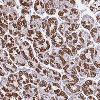 Immunohistochemistry-Paraffin: OR13A1 Antibody [NBP2-31665]