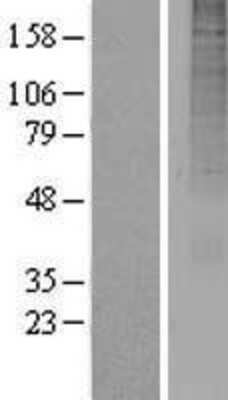 Western Blot: OR13A1 Overexpression Lysate [NBP2-08933]