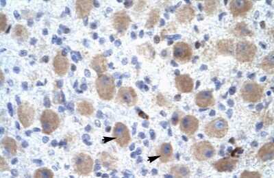 Immunohistochemistry: OR13C9 Antibody [NBP1-79985]