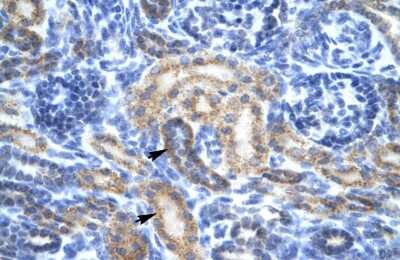 Immunohistochemistry: OR13C9 Antibody [NBP1-79985]