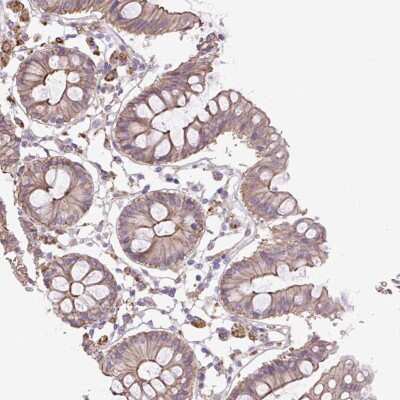 Immunohistochemistry: OR13D1 Antibody [NBP2-49203]