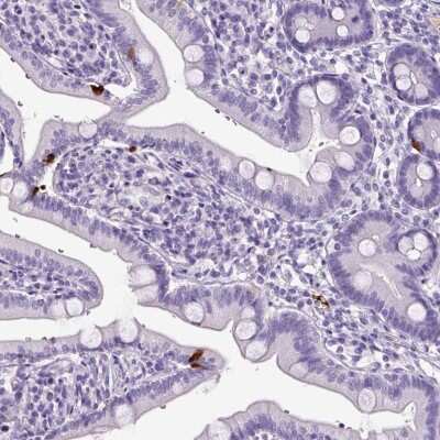 Immunohistochemistry: OR14A2 Antibody [NBP2-49057]