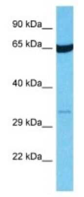 Western Blot: OR14I1 Antibody [NBP3-09860]