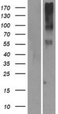 Western Blot: OR14I1 Overexpression Lysate [NBP2-08905]