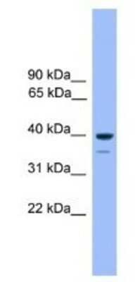 Western Blot: OR1C1 Antibody [NBP1-69093]