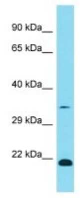 Western Blot: OR1K1 Antibody [NBP3-09759]