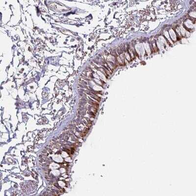 Immunohistochemistry: OR2D3 Antibody [NBP2-49049]
