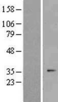 Western Blot: OR2F1 Overexpression Lysate [NBL1-13954]