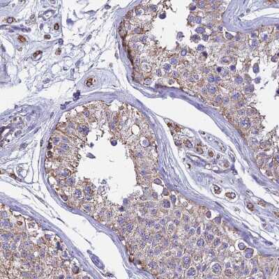 Immunohistochemistry-Paraffin: OR2W3 Antibody [NBP1-92227]