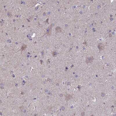 Immunohistochemistry-Paraffin: OR2W3 Antibody [NBP1-92227]