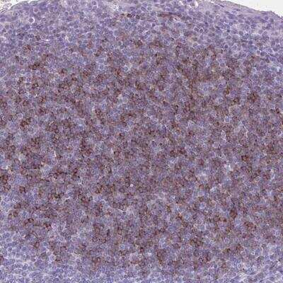 Immunohistochemistry-Paraffin: OR4B1 Antibody [NBP2-32461]