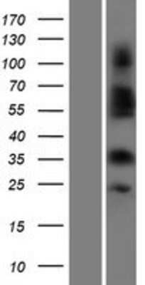 Western Blot: OR4C3 Overexpression Lysate [NBP2-08894]