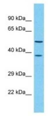 Western Blot: OR4D1 Antibody [NBP3-09782]