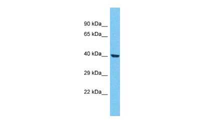 Western Blot: OR4F21 Antibody [NBP3-09788]