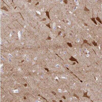 Immunohistochemistry: OR4N4 Antibody [NBP2-30779]
