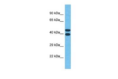 Western Blot: OR4Q3 Antibody [NBP2-83320]