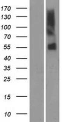 Western Blot: OR51A7 Overexpression Lysate [NBP2-08906]