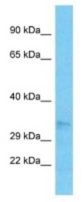 Western Blot: OR52N5 Antibody [NBP3-09868]