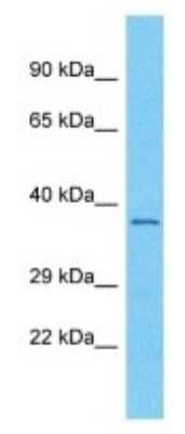 Western Blot: OR56A3 Antibody [NBP3-09871]