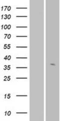 Western Blot: OR56A3 Overexpression Lysate [NBP2-08939]