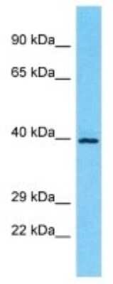 Western Blot: OR5M10 Antibody [NBP3-09817]