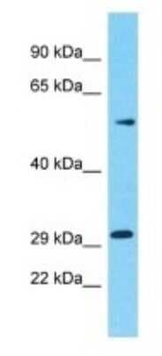 Western Blot: OR5M10 Antibody [NBP3-09819]