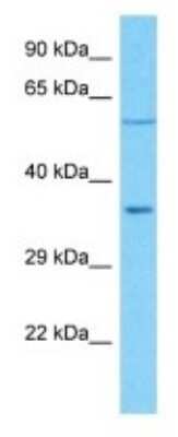 Western Blot: OR5R1 Antibody [NBP3-09821]