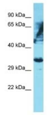 Western Blot: OR6K2 Antibody [NBP3-09809]