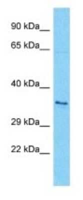 Western Blot: OR7A17 Antibody [NBP3-09812]