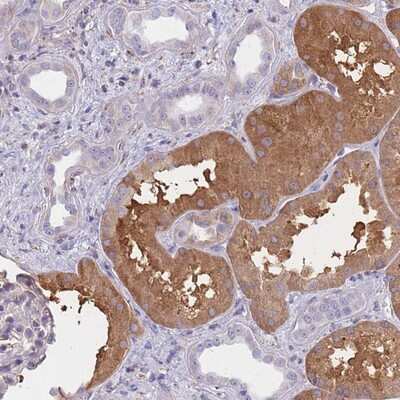 Immunohistochemistry-Paraffin: OR7C2 Antibody [NBP2-13715]