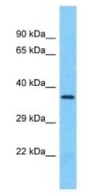 Western Blot: OR8B3 Antibody [NBP3-09815]