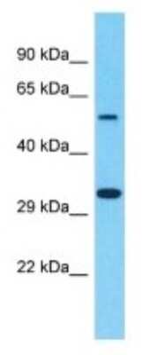 Western Blot: OR8B4 Antibody [NBP3-09816]