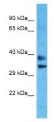 Western Blot: OR8H1 Antibody [NBP3-09826]
