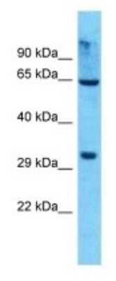 Western Blot: OR8K5 Antibody [NBP3-09831]