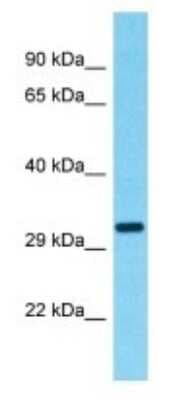 Western Blot: OR9G9 Antibody [NBP3-09839]