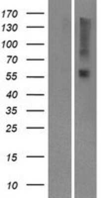 Western Blot: OR9I1 Overexpression Lysate [NBP2-08879]