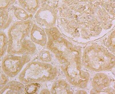 Immunocytochemistry/ Immunofluorescence: ORAI3 Antibody [NBP2-76956]