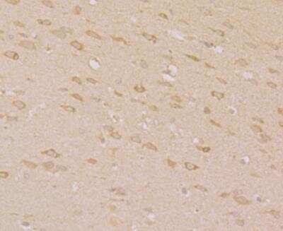 Immunohistochemistry-Paraffin: ORAI3 Antibody [NBP2-76956]