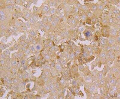 Immunohistochemistry-Paraffin: ORAI3 Antibody [NBP2-76956]