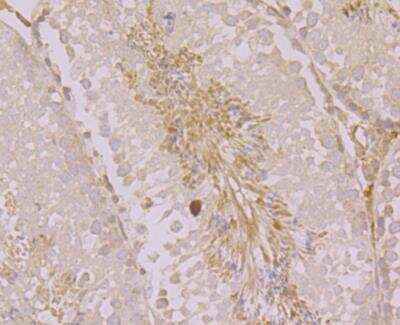 Immunohistochemistry-Paraffin: ORAI3 Antibody [NBP2-76956]