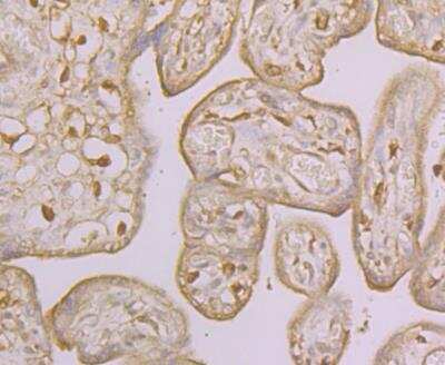 Immunohistochemistry-Paraffin: ORAI3 Antibody [NBP2-76956]
