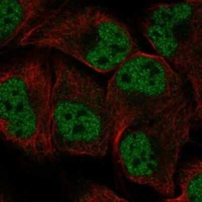 Immunocytochemistry/ Immunofluorescence: ORC1 Antibody [NBP3-17790]