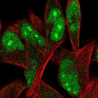 Immunocytochemistry/ Immunofluorescence: ORC4L Antibody [NBP2-56938]
